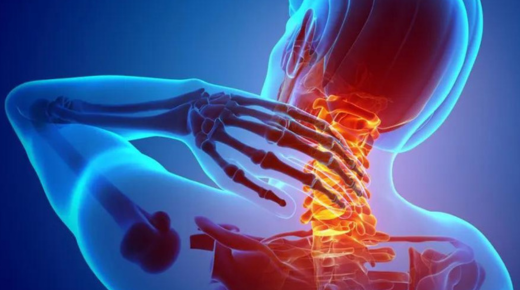 Neck Injury Settlement Without Surgery - What You Need to Know