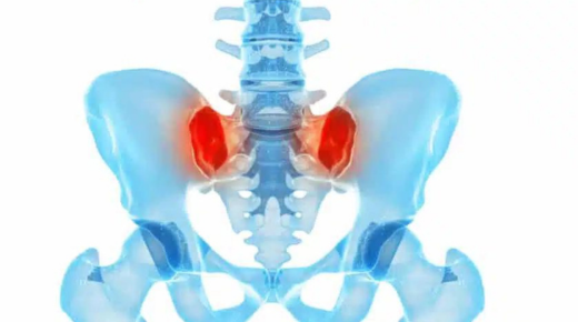 Recovering from SI Joint Fusion Surgery - Driving Guidelines and Timeline