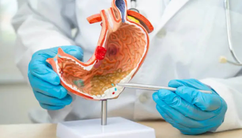 Gastroenterology Hospital In Hyderabad
